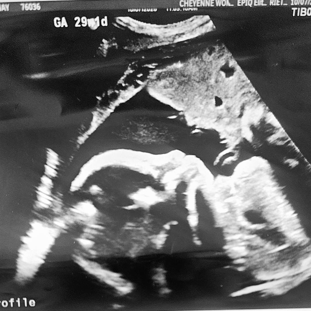 Photo shared by Brittany for their Babylist baby registry.