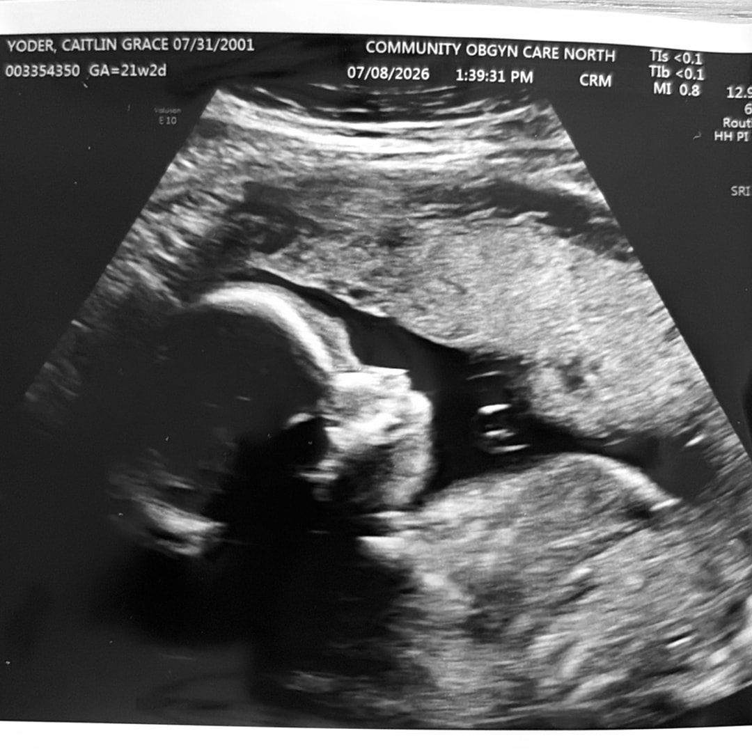 Photo shared by Caitlin for their Babylist baby registry.