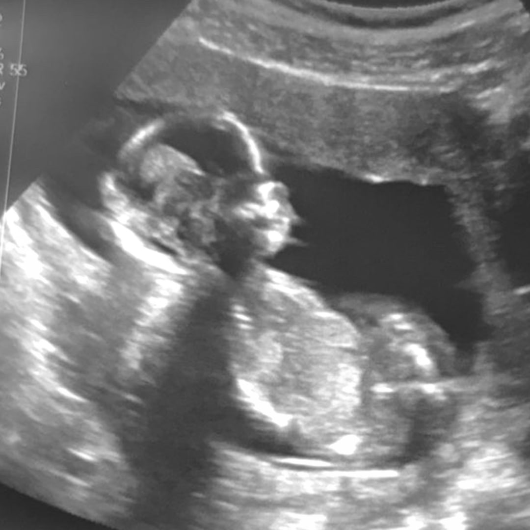 Photo shared by Gyzelle for their Babylist baby registry.