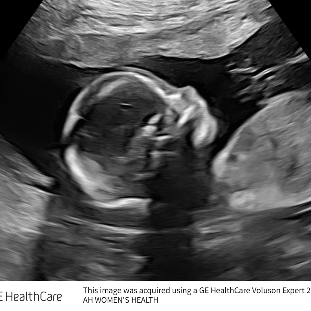 Photo shared by Amber for their Babylist baby registry.