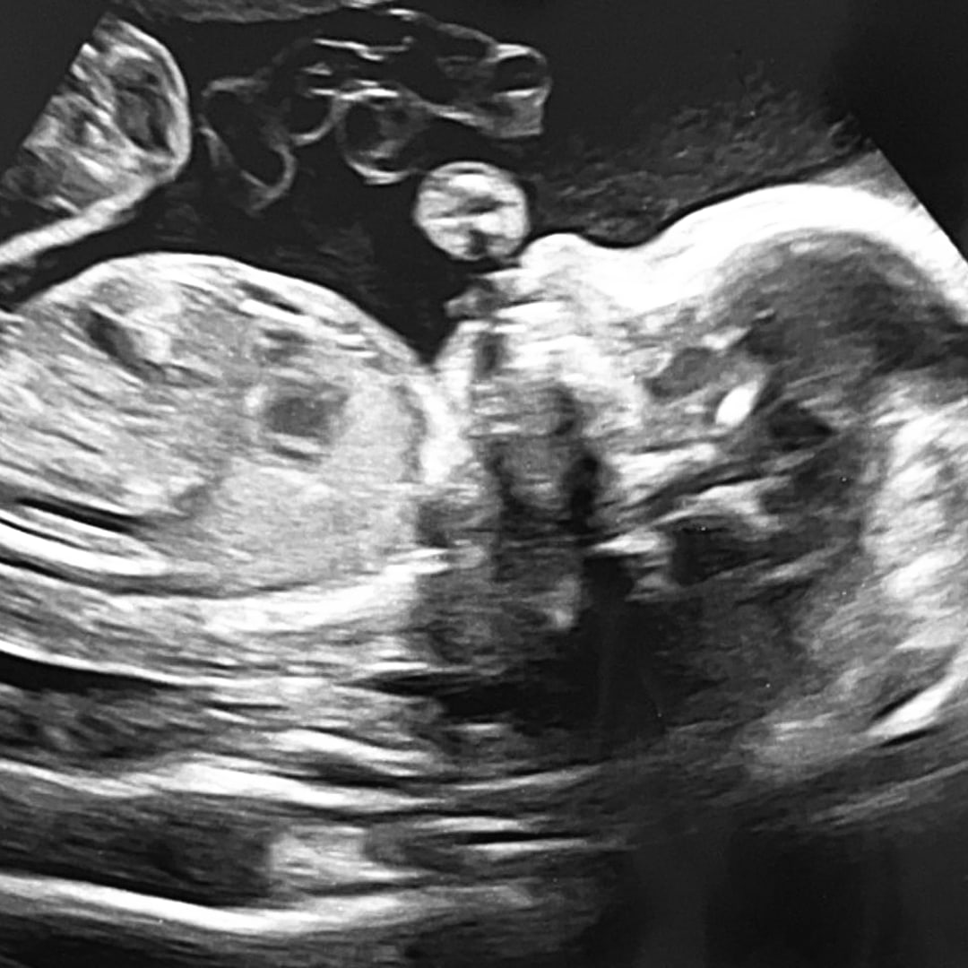 Photo shared by Magdalen for their Babylist baby registry.