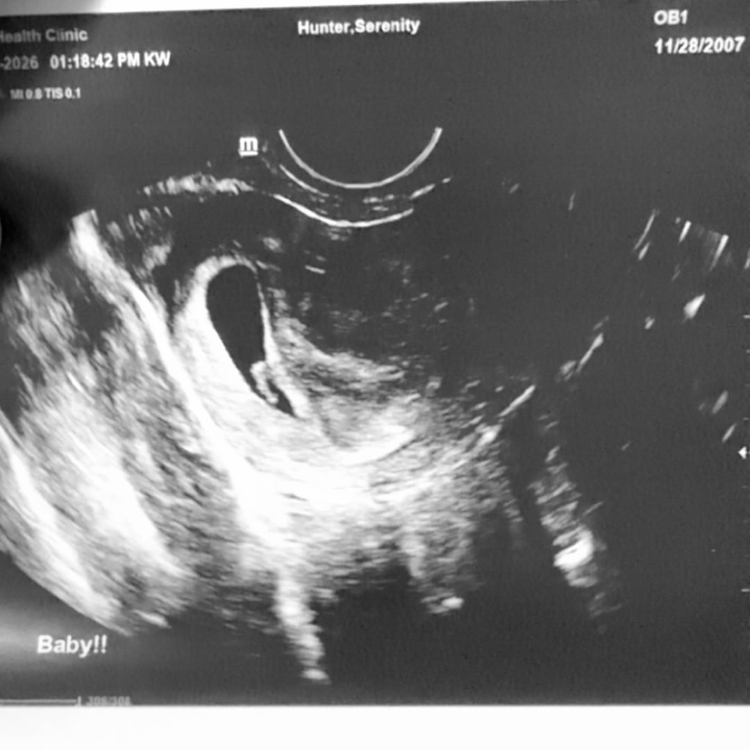 Photo shared by Serenity for their Babylist baby registry.