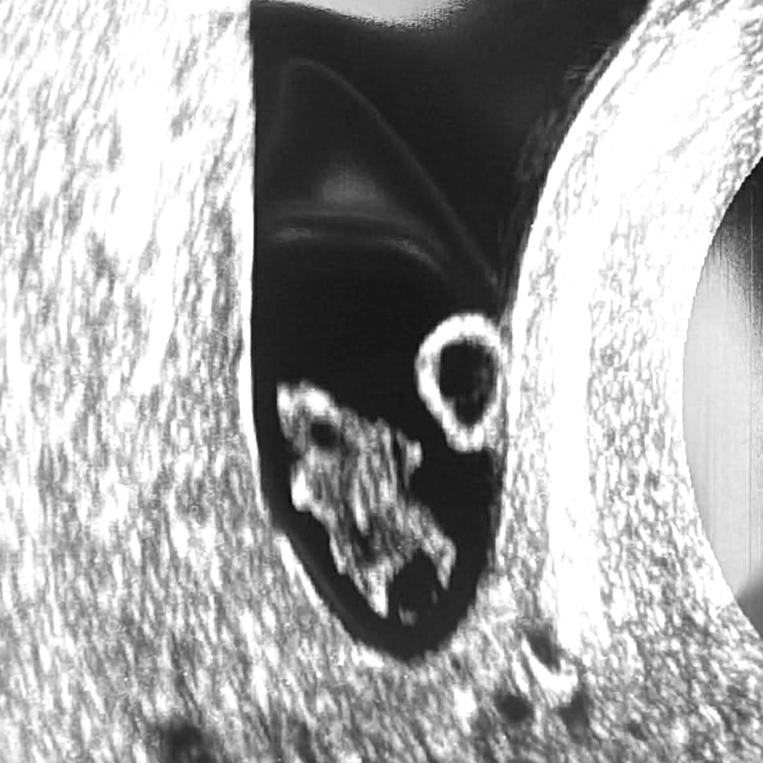 Photo shared by Sarah for their Babylist baby registry.