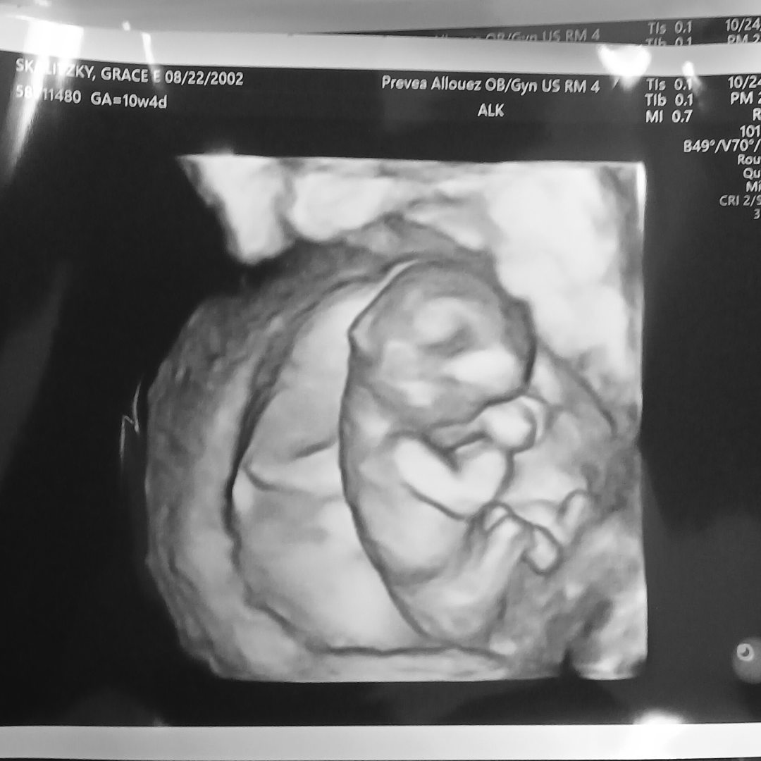 Photo shared by Grace for their Babylist baby registry.