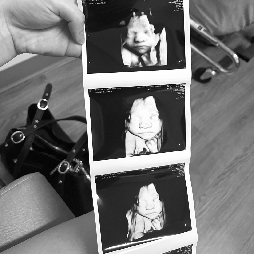 Photo shared by Emma for their Babylist baby registry.