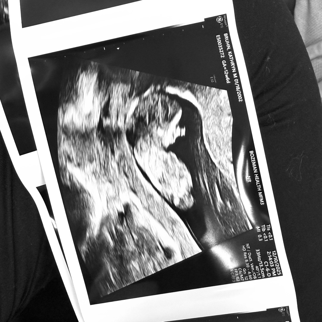 Photo shared by Katie for their Babylist baby registry.