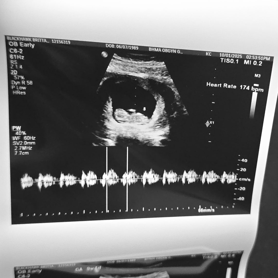 Photo shared by Brittainy for their Babylist baby registry.