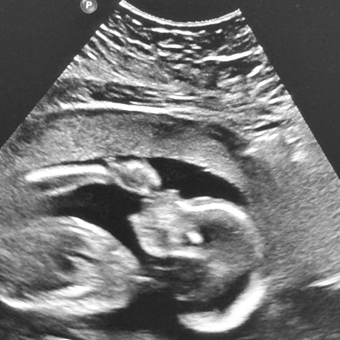 Photo shared by Julie for their Babylist baby registry.