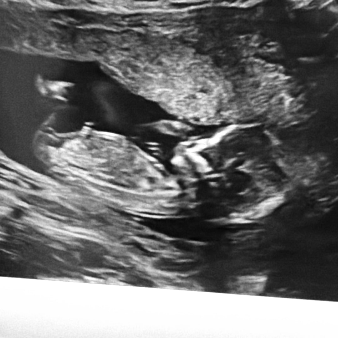 Photo shared by Vivian for their Babylist baby registry.