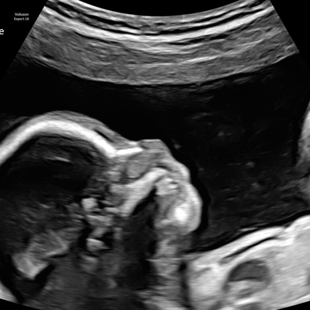 Photo shared by Aleksa for their Babylist baby registry.