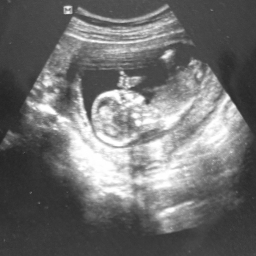 Photo shared by Raged for their Babylist baby registry.