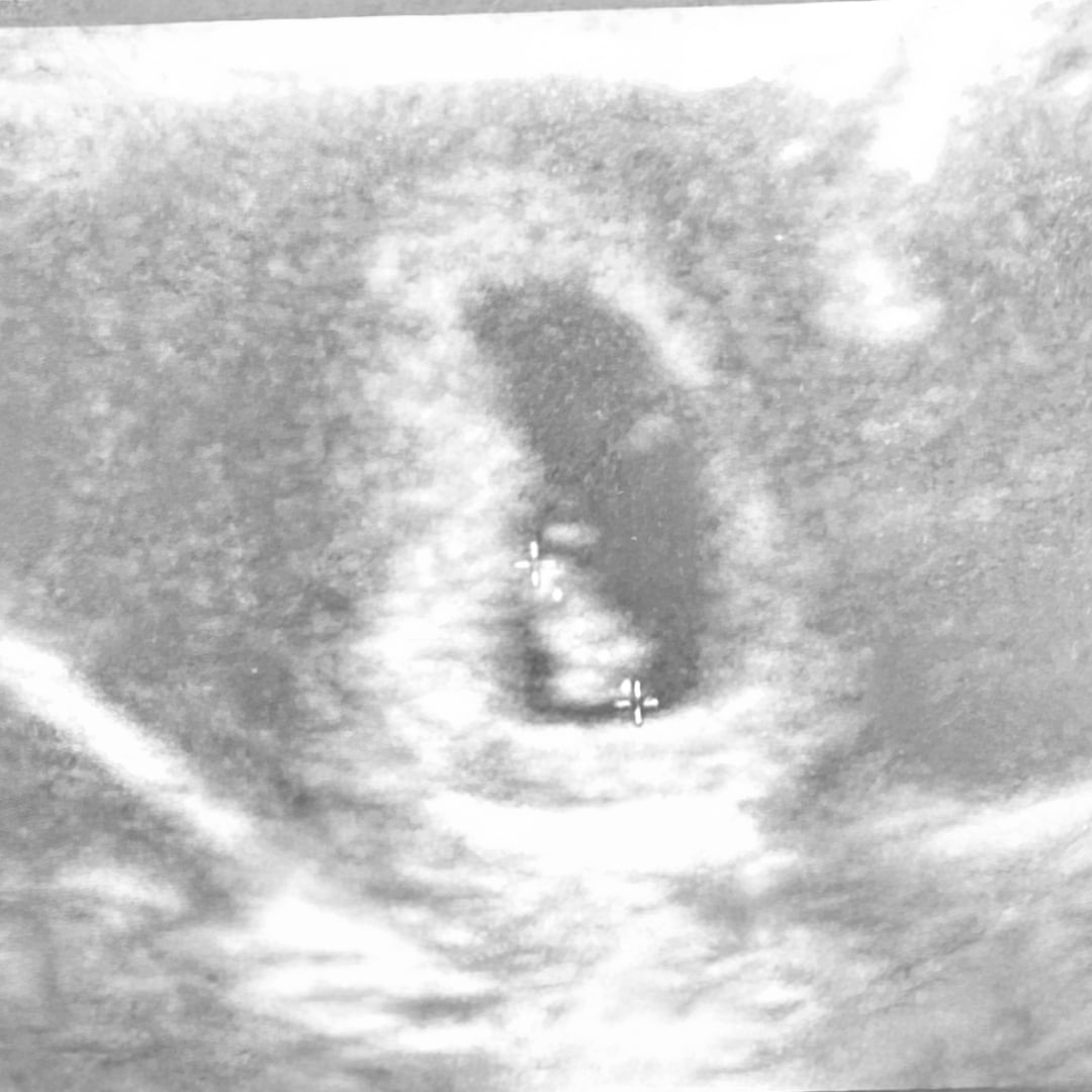 Photo shared by Brielle for their Babylist baby registry.