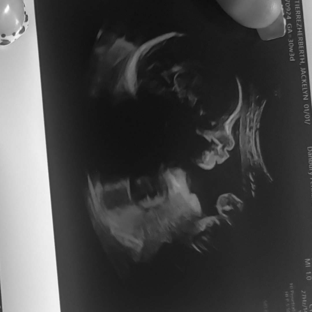 Photo shared by Jackelyn for their Babylist baby registry.