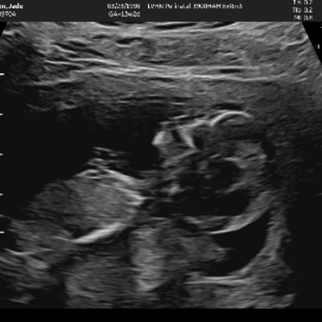 Photo shared by Jade for their Babylist baby registry.