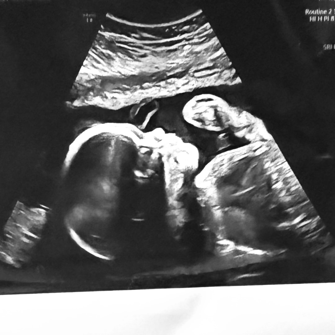 Photo shared by Harley for their Babylist baby registry.