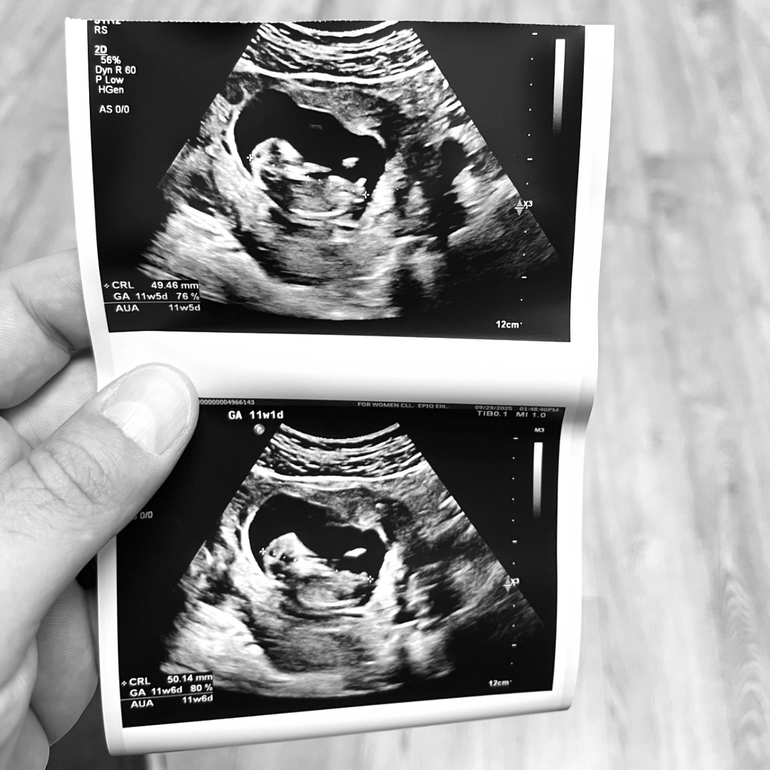 Photo shared by Rachel for their Babylist baby registry.