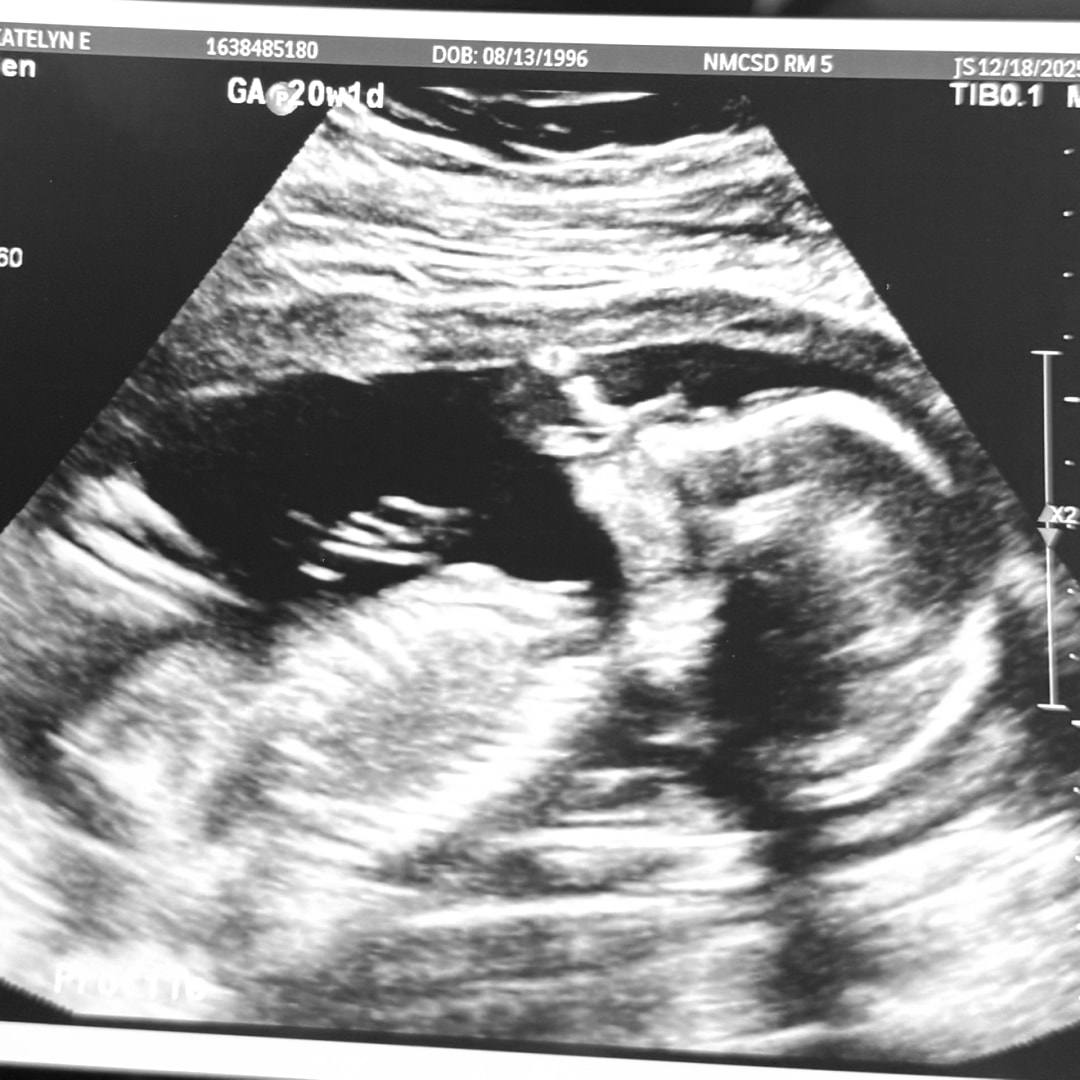 Photo shared by Katelyn for their Babylist baby registry.