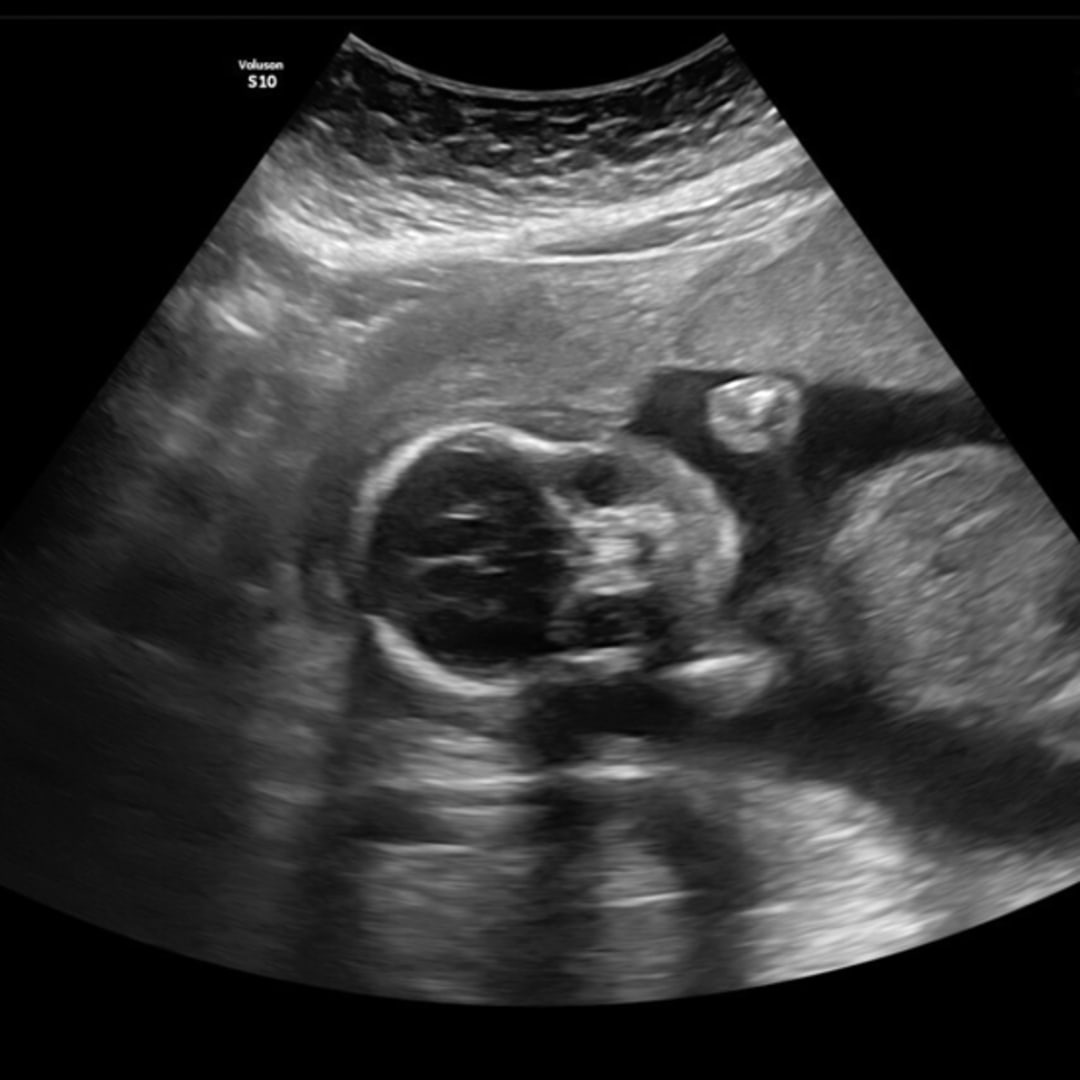 Photo shared by Alanna for their Babylist baby registry.