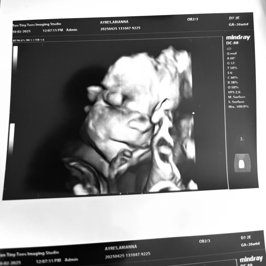 Photo shared by Arianna for their Babylist baby registry.