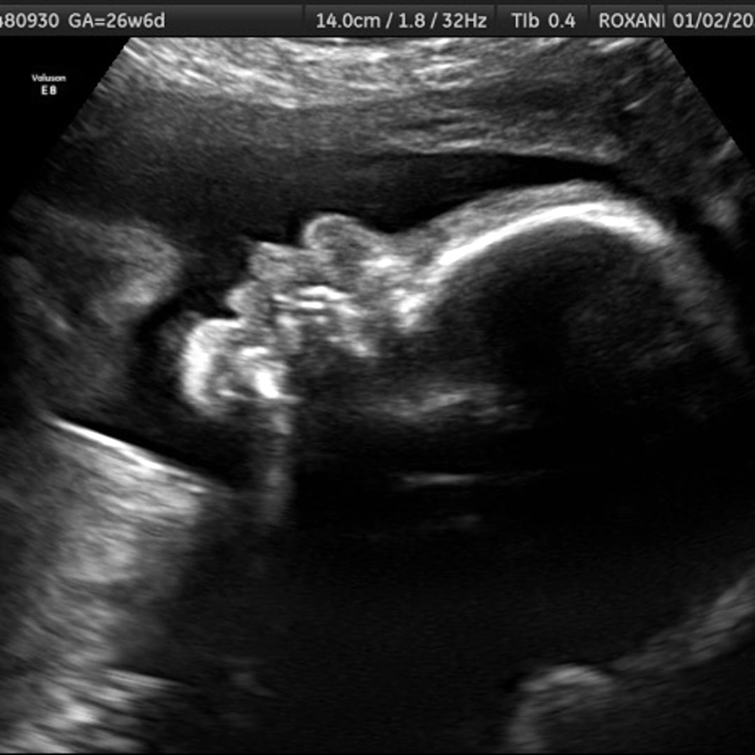 Photo shared by Joanna for their Babylist baby registry.