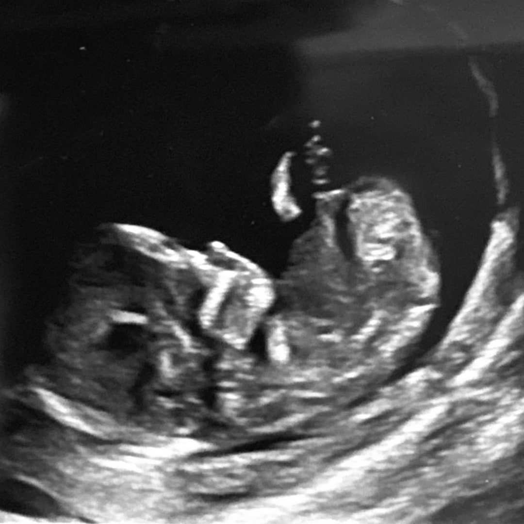 Photo shared by Madeline for their Babylist baby registry.