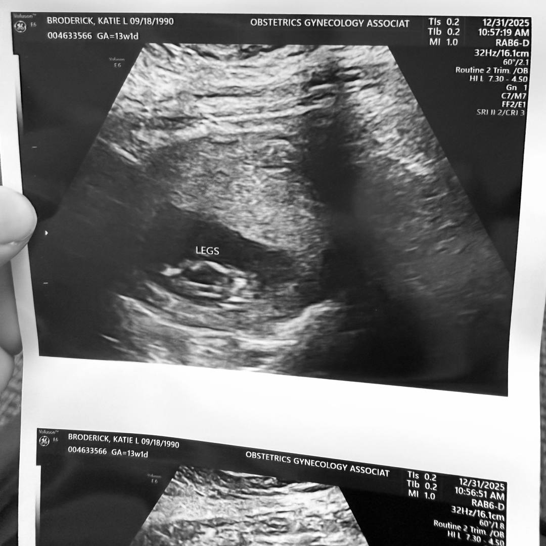 Photo shared by Katie for their Babylist baby registry.