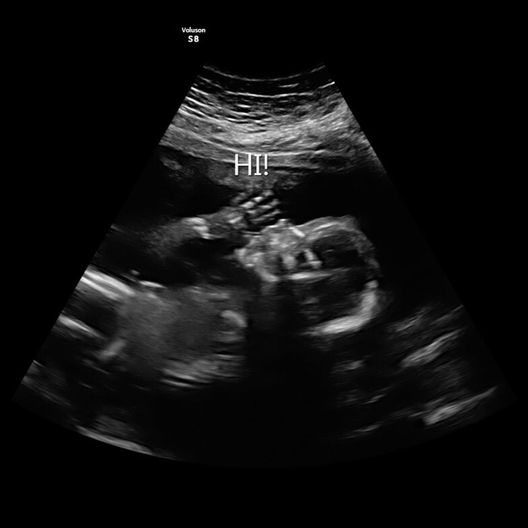 Photo shared by Georgia for their Babylist baby registry.