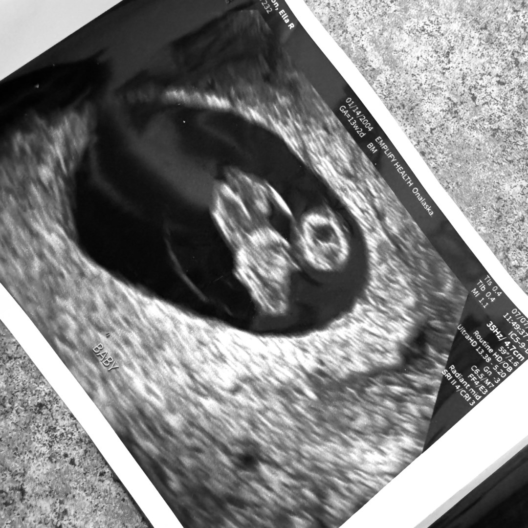 Photo shared by Ella for their Babylist baby registry.