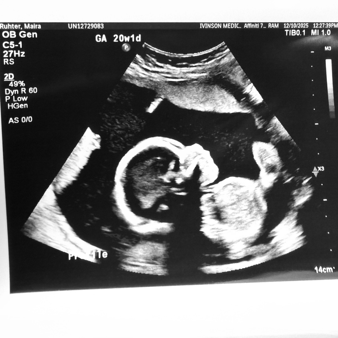 Photo shared by Maira & Justin for their Babylist baby registry.