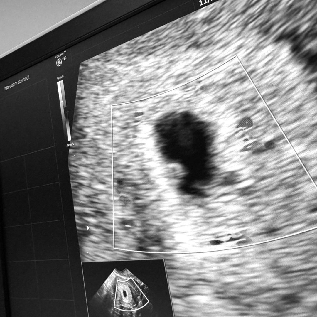 Photo shared by Malia for their Babylist baby registry.