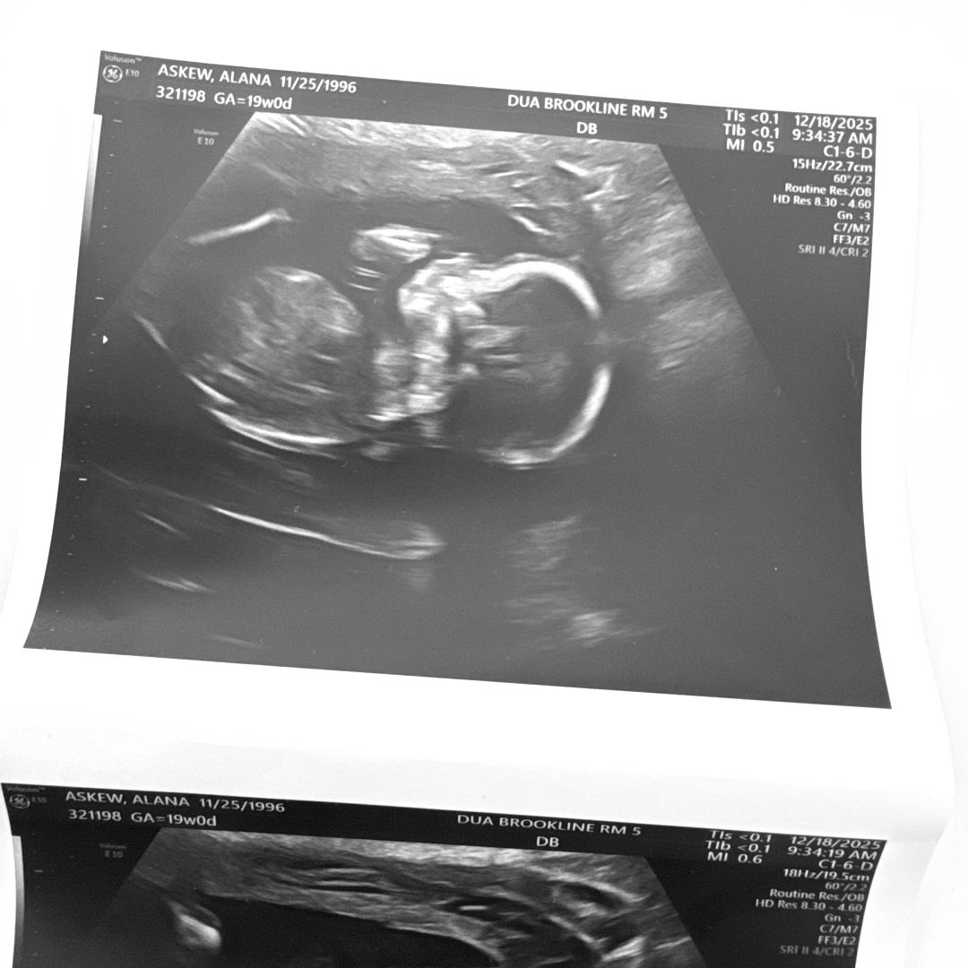 Photo shared by Alana for their Babylist baby registry.