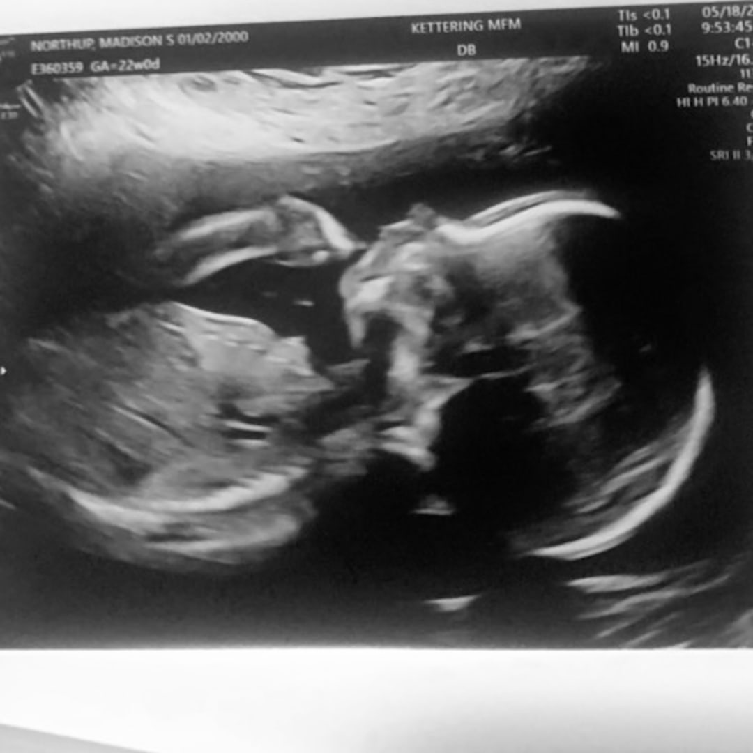 Photo shared by Madison for their Babylist baby registry.
