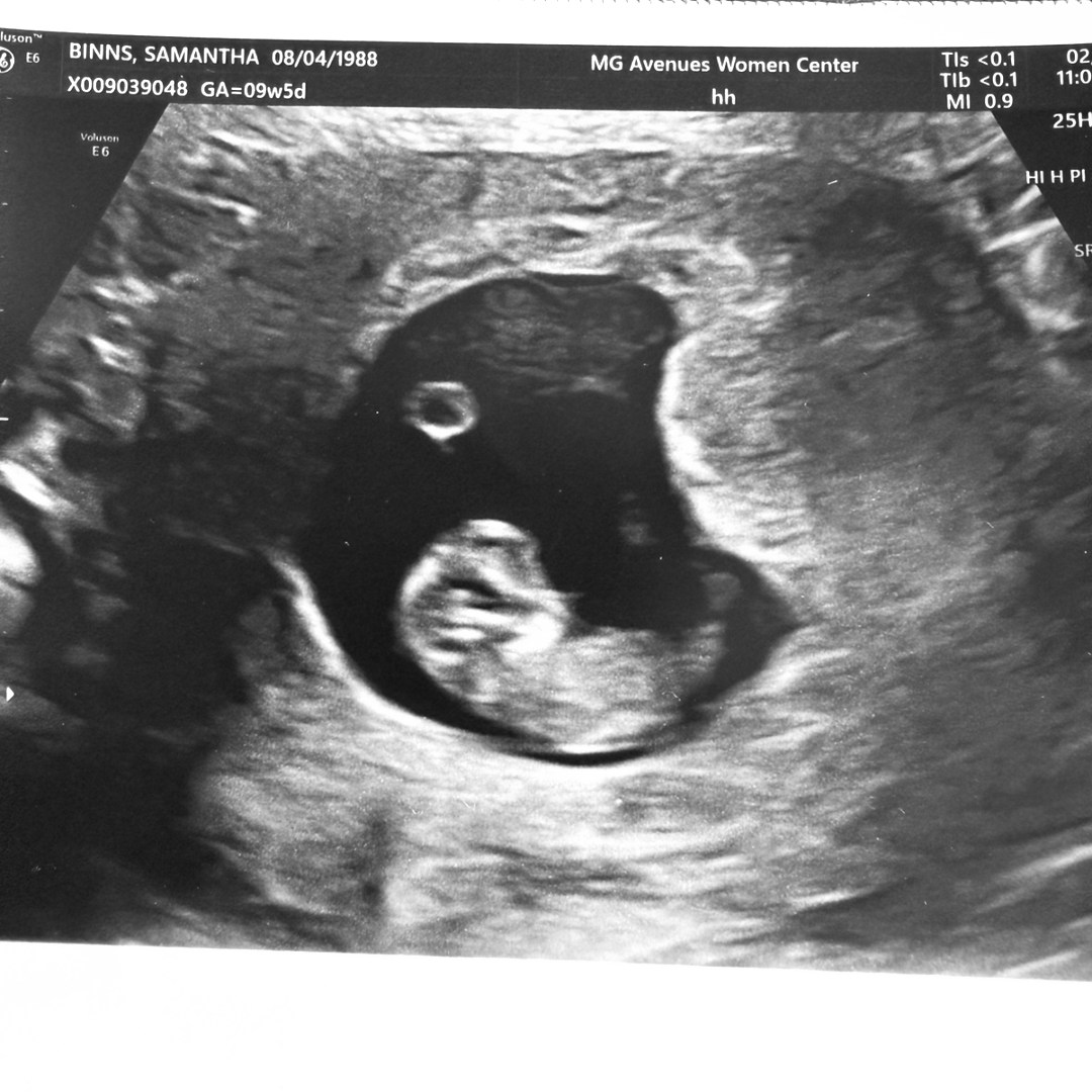 Photo shared by Samantha for their Babylist baby registry.