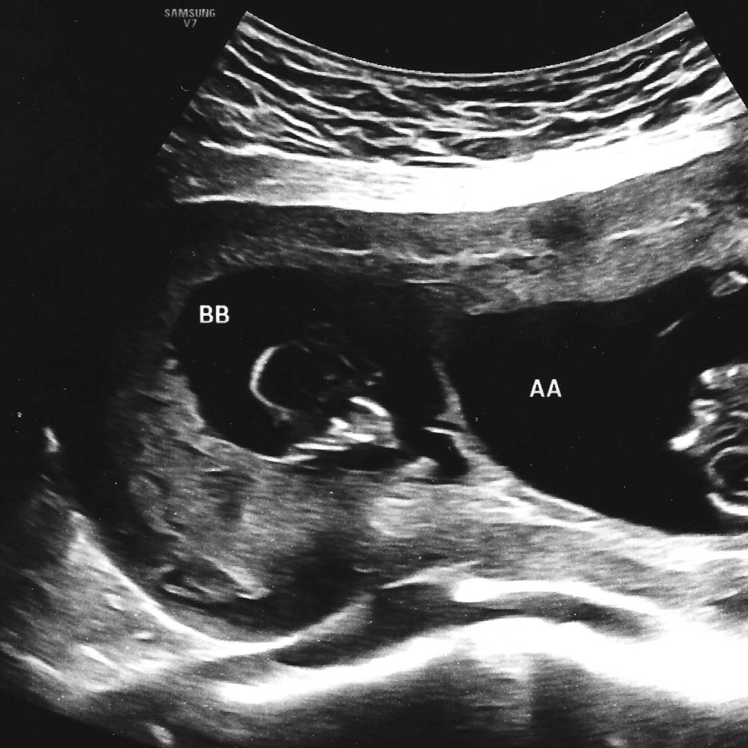 Photo shared by Tia for their Babylist baby registry.