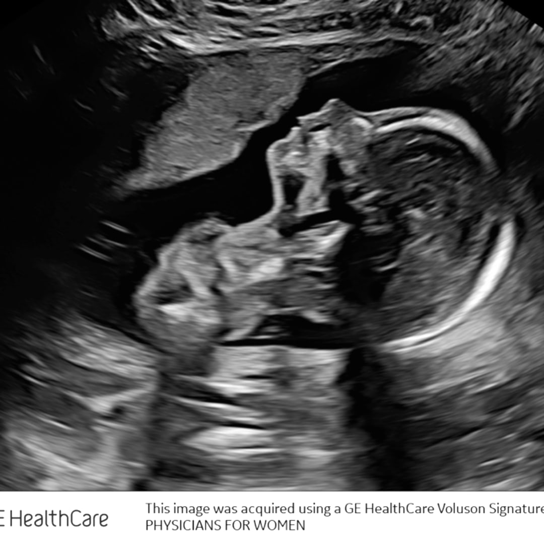 Photo shared by Savanna for their Babylist baby registry.