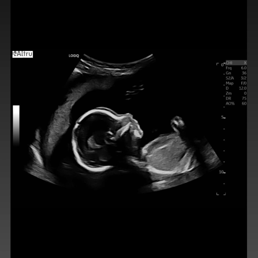 Photo shared by Haylee for their Babylist baby registry.