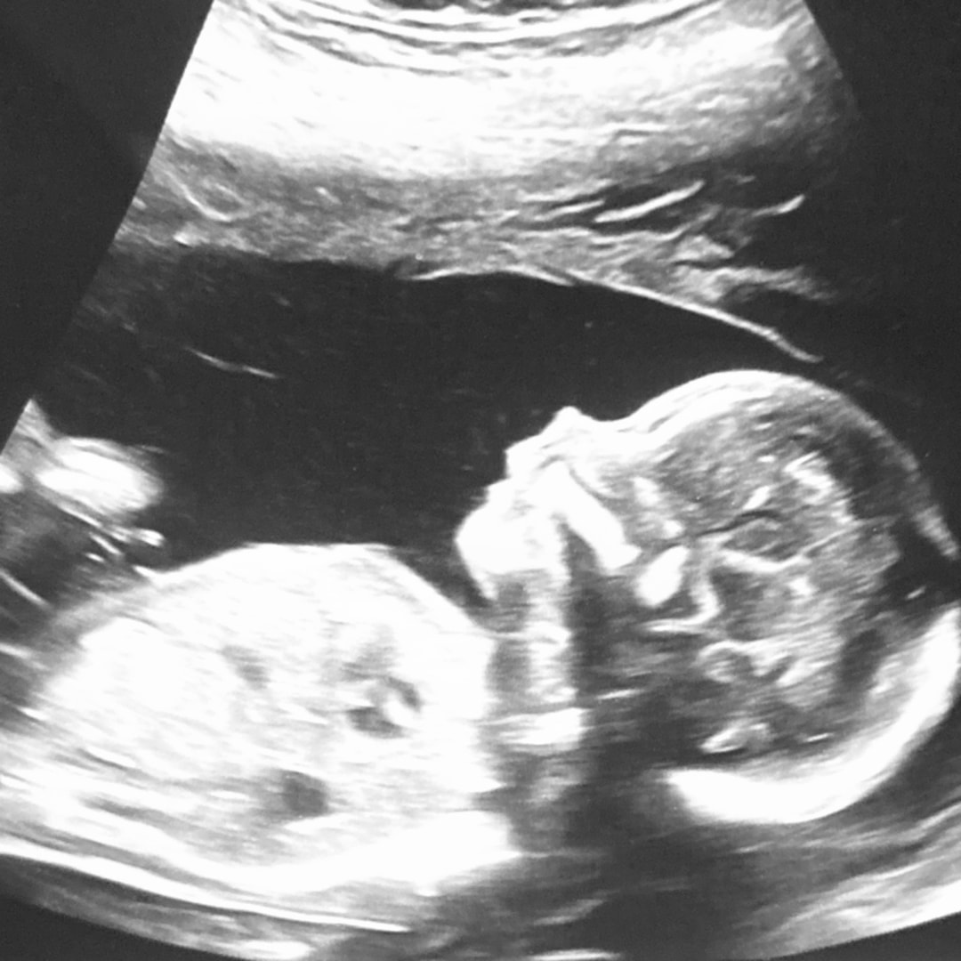Photo shared by Skylar for their Babylist baby registry.