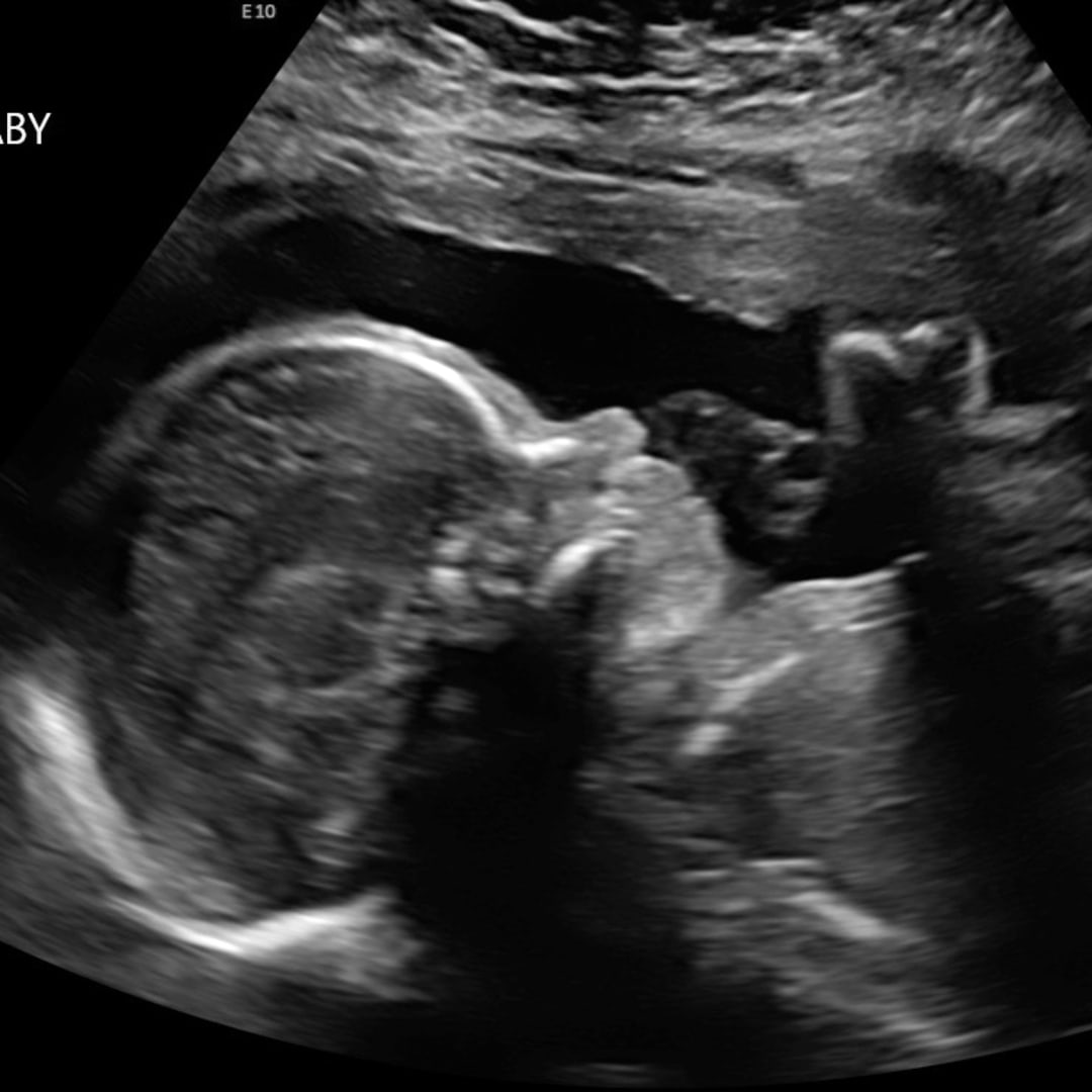 Photo shared by Lindsey for their Babylist baby registry.