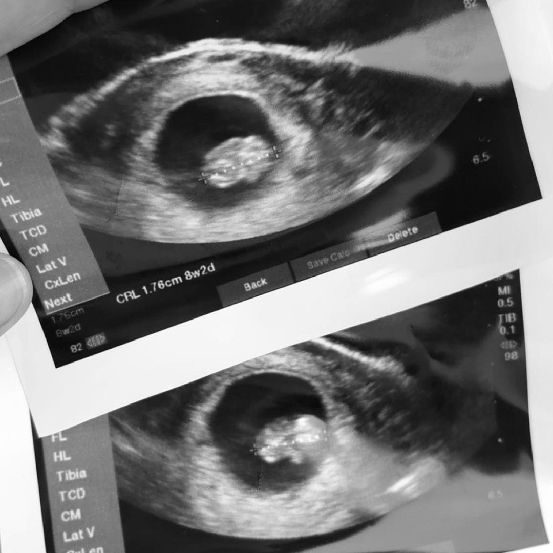 Photo shared by Reagan for their Babylist baby registry.