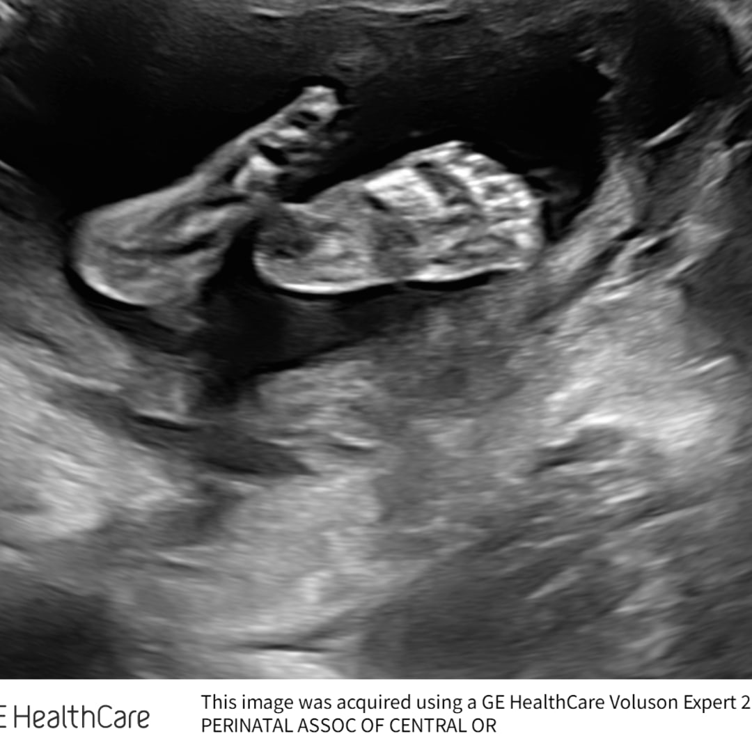 Photo shared by Rebekah for their Babylist baby registry.