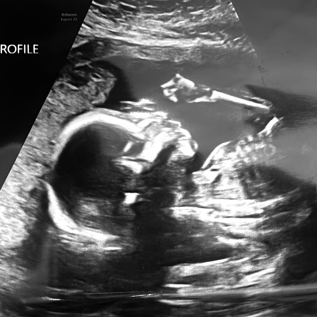 Photo shared by A'Nyha for their Babylist baby registry.