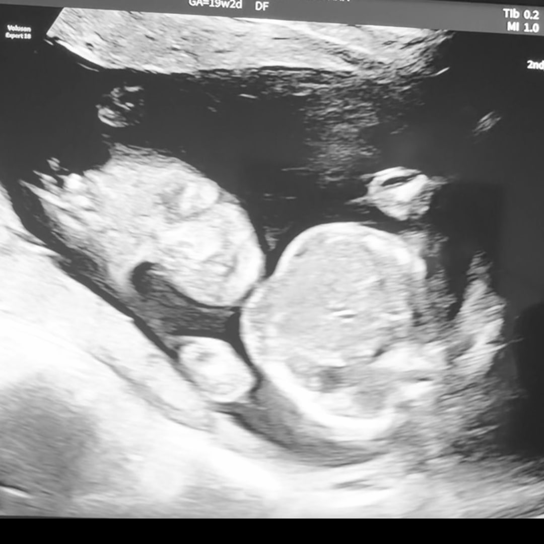 Photo shared by Kaitlyn for their Babylist baby registry.
