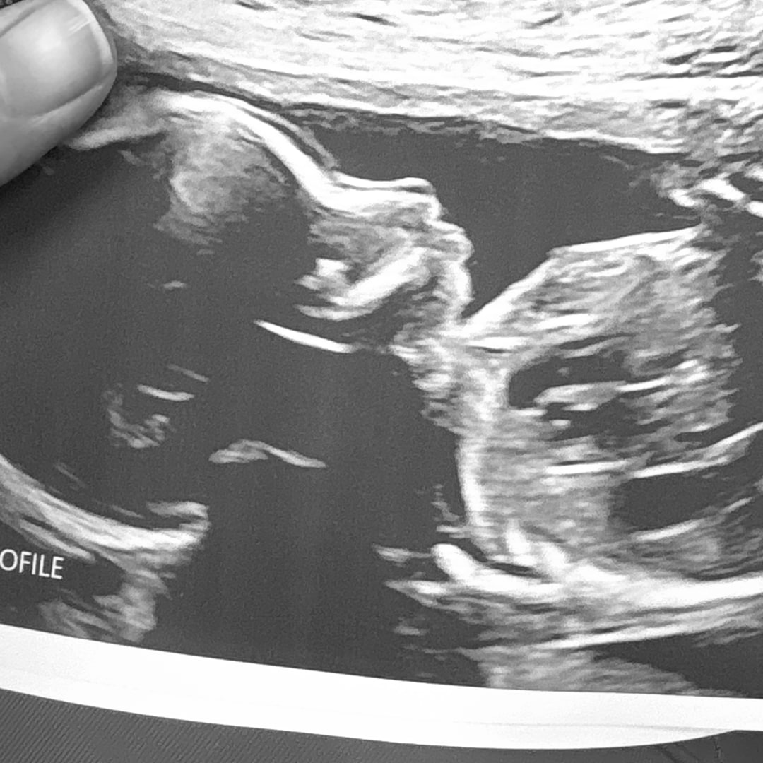 Photo shared by Ashley for their Babylist baby registry.