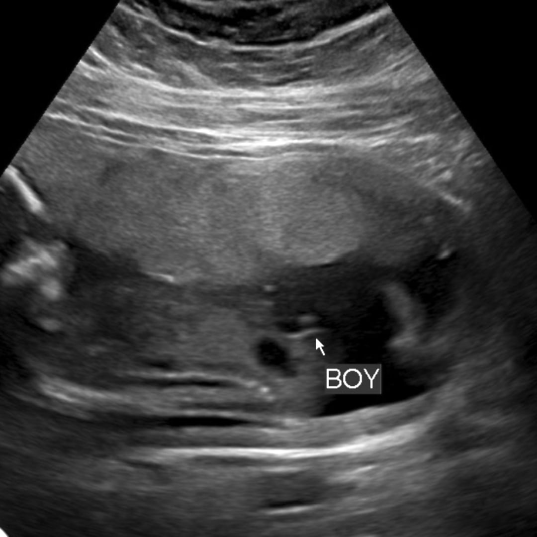 Photo shared by Jocelyn for their Babylist baby registry.