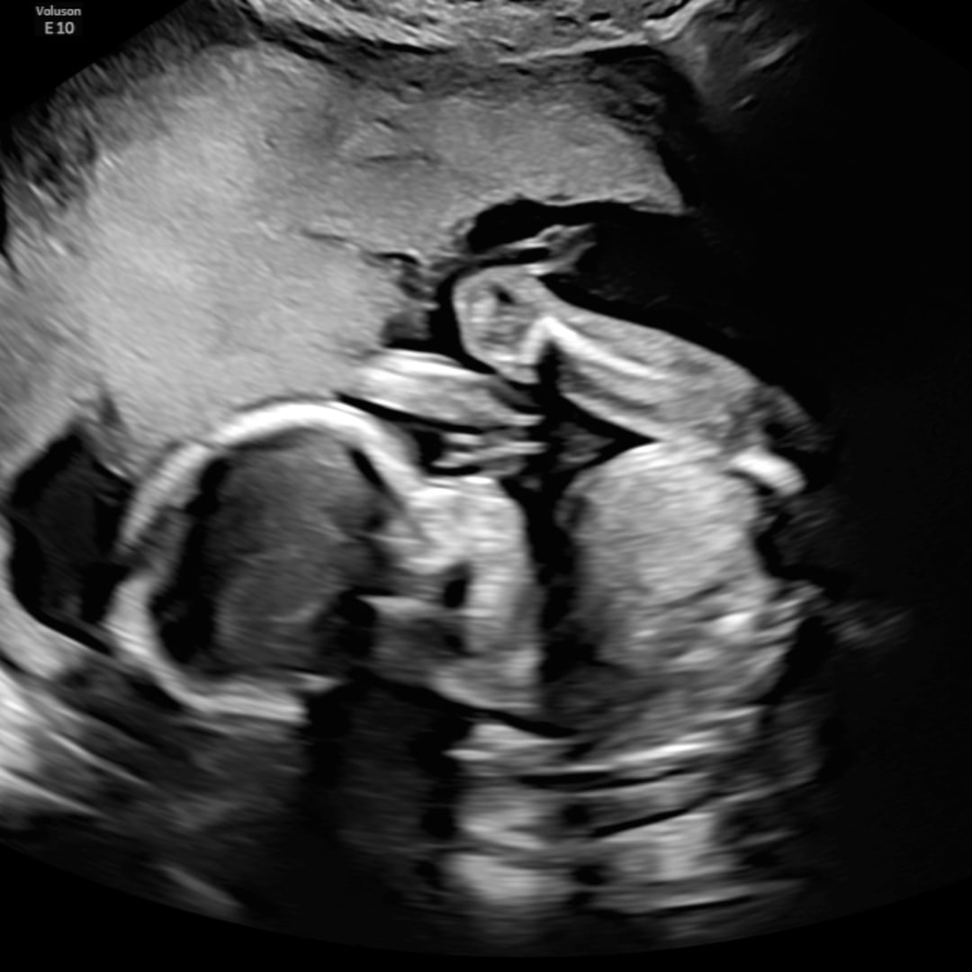 Photo shared by Hannah for their Babylist baby registry.