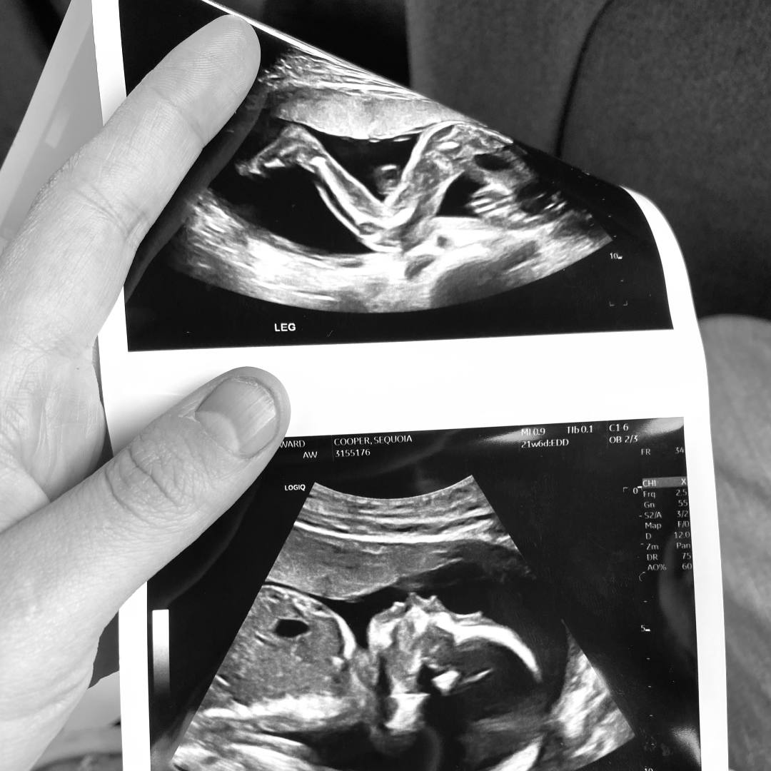 Photo shared by Sequoia for their Babylist baby registry.