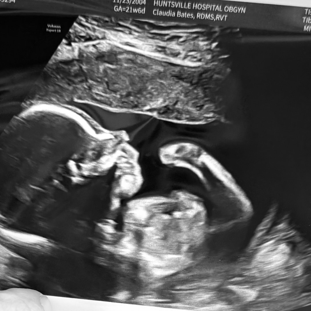 Photo shared by Lilliane for their Babylist baby registry.