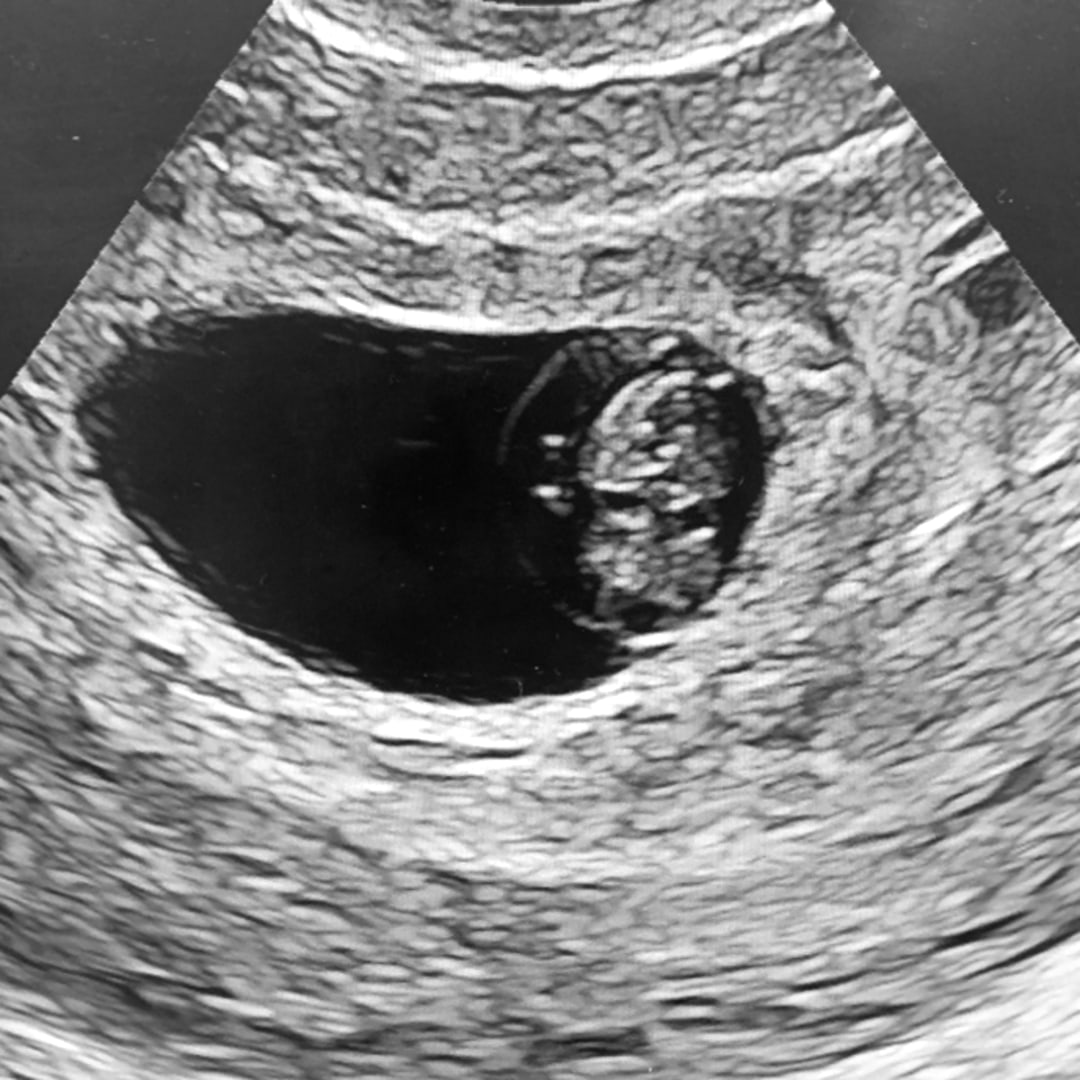 Photo shared by Gisele for their Babylist baby registry.