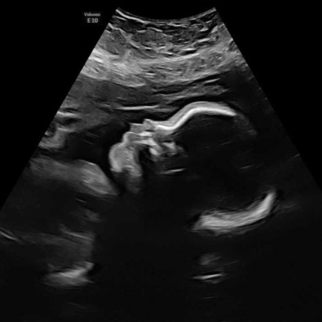 Photo shared by Quaniya for their Babylist baby registry.