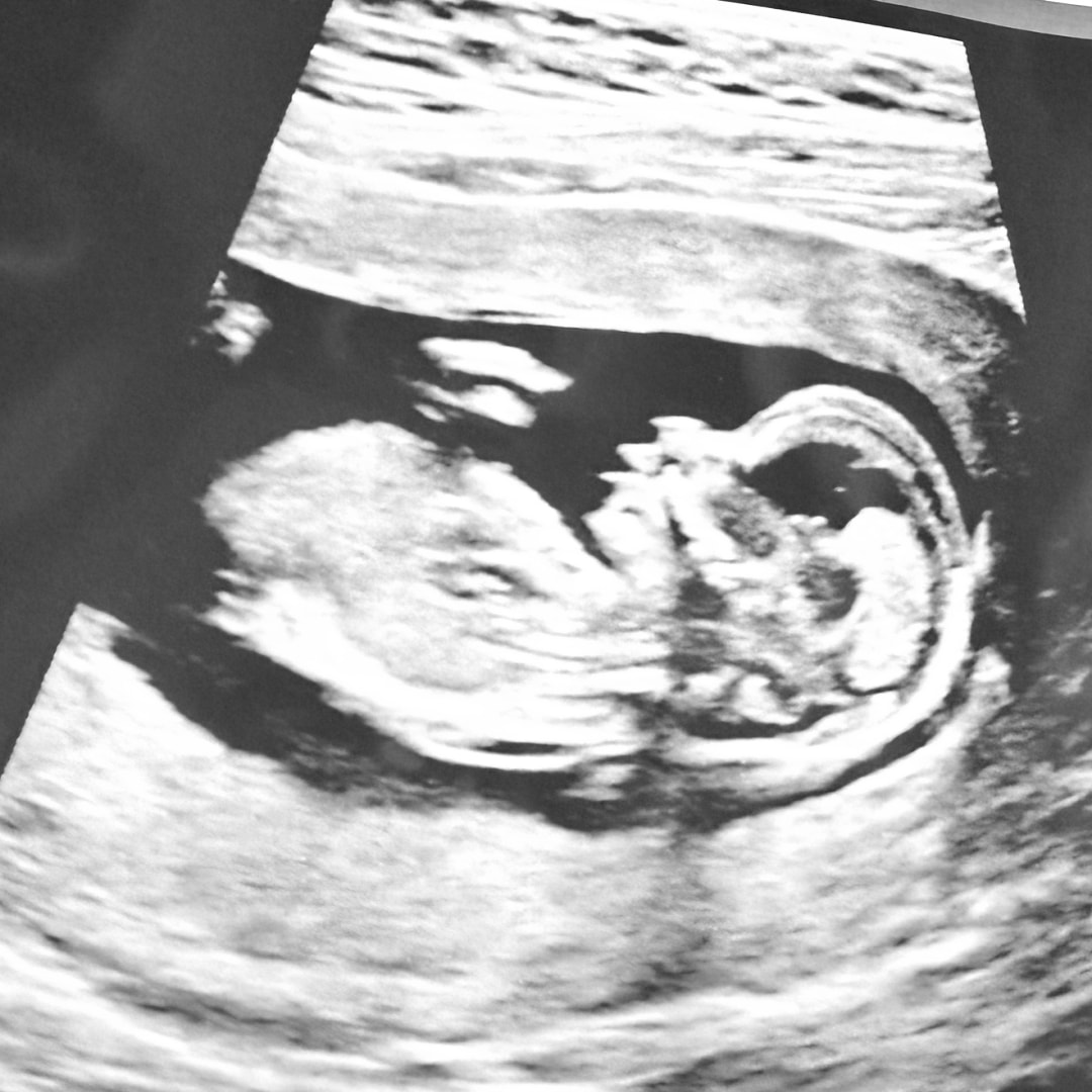 Photo shared by Erin for their Babylist baby registry.